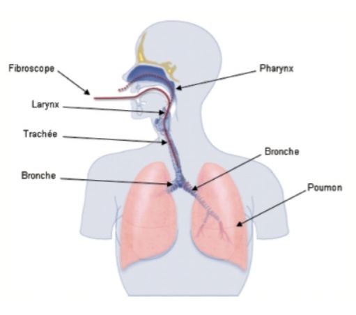 schéma fibroscopie bronchique